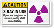 If You Are Pregnant Notify Staff Immediately Sign
